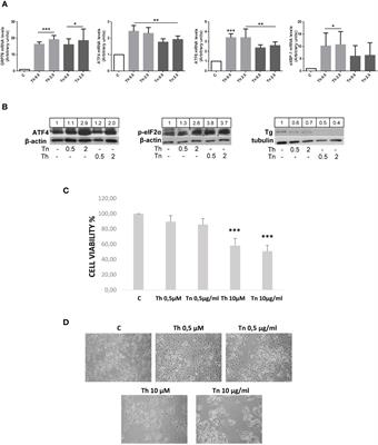 The Pervasive Effects of ER Stress on a Typical Endocrine Cell: Dedifferentiation, Mesenchymal Shift and Antioxidant Response in the Thyrocyte